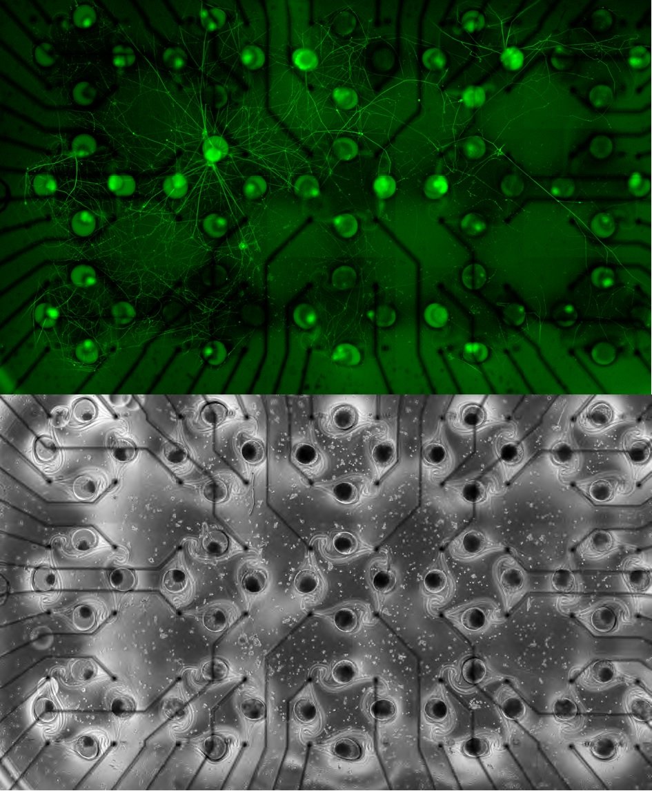 microfluidics: bottom up neuroscience with microfluidic