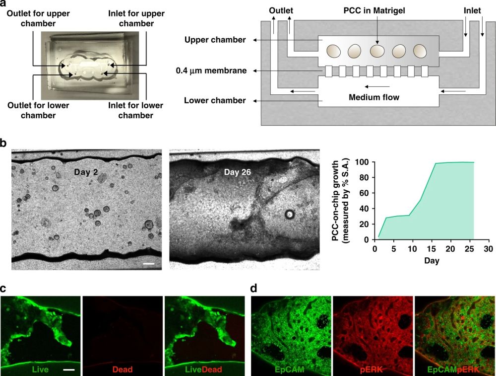 Pancreatic cancer on chip